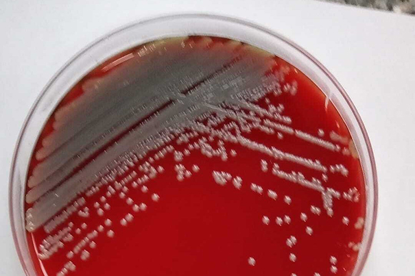 bacterias